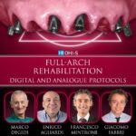Full-arch rehabilitation: digital and analogue Protocols