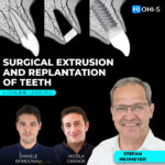 Surgical Extrusion and Replantation of Teeth