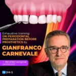 Surgical Periodontics: Preparation for Prosthetics