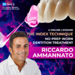The Index Technique. No-prep worn dentition treatment